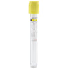 Urine collection vacuum tube, 13x100mm (6.5mL), yellow cap