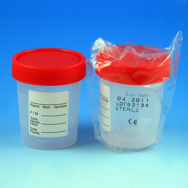 Containers for Urine Collection from Globe Scientific
