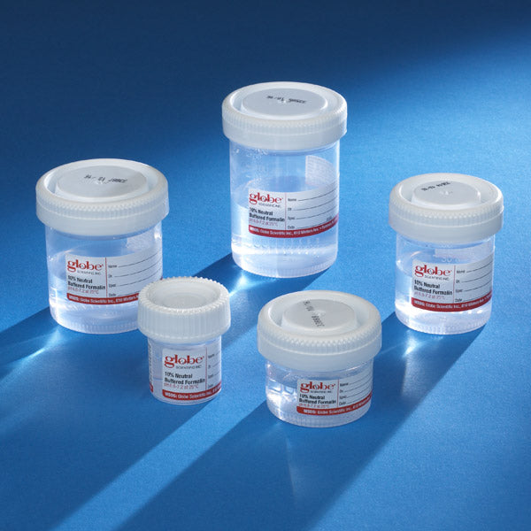 Formalin Containers from Globe Scientific